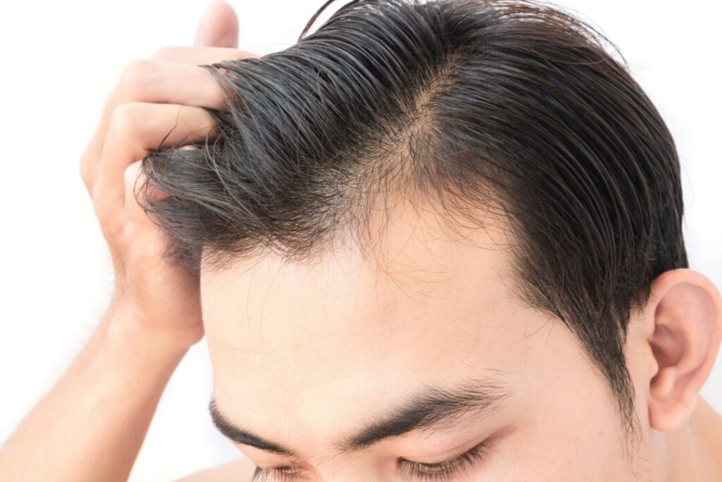 Hair transplantation