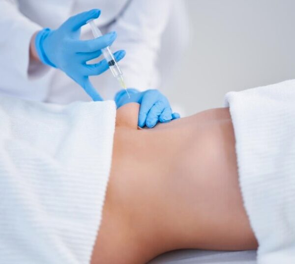 lipolysis